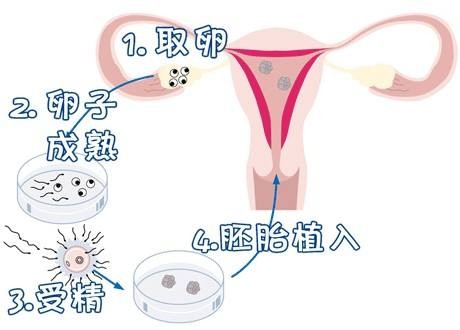 有偿试管代妈机构
